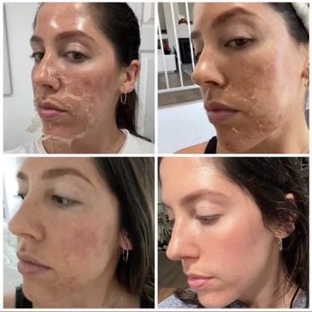 Skinlab South Bay - Skin Care Near Me - Manhattan Beach, California