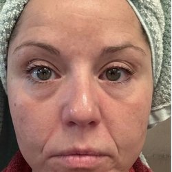 Emmaline Spa - Before