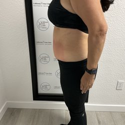After Cryo
