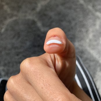 Ladue Nails and Spa - Thickness of nail. And chipping on both sides of nail. Bleeding on thumb where she nicked me - Nail Salons Near Me - Saint Louis, Missouri Ladue Nails and Spa - Thickness of nail. And chipping on both sides of nail. Bleeding on thumb where she nicked me - Nail Salons Near Me - Saint Louis, Missouri