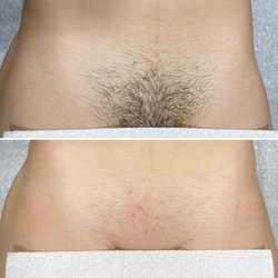 Bare Beauty By Myranda - Brazilian wax