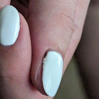 Eagle Nails Salon - Thumb bleeding after acrylic nails were taken off. - Nail Salons Near Me - Kaneohe, Hawaii