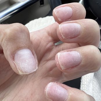 Ocean View Nails - After she tried to use a hot towel to "fix it" - Nail Salons Near Me - San Clemente, California