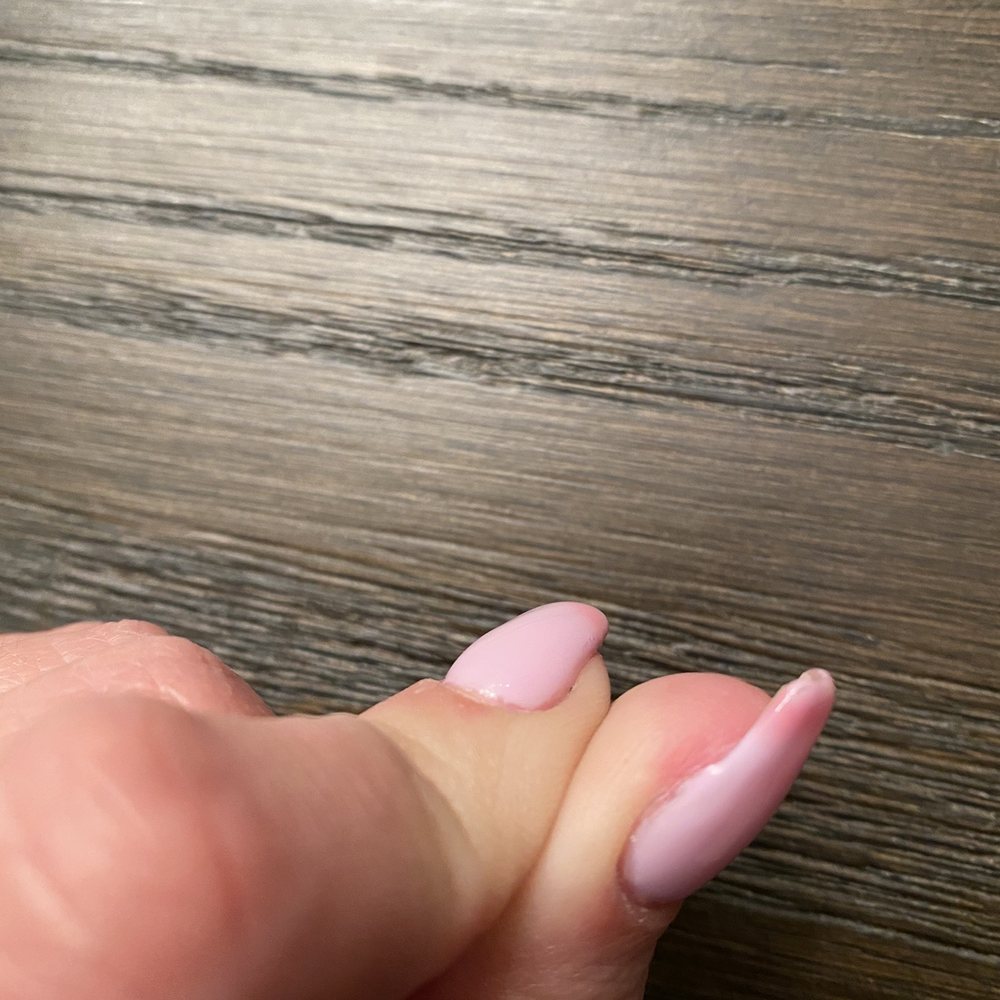 Q Nails - Hurt skin - Nail Salons Near Me - Saint Cloud, Minnesota