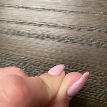 Q Nails - Hurt skin - Nail Salons Near Me - Saint Cloud, Minnesota