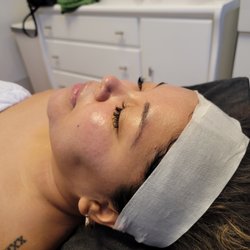 Stunning Beauty Aesthetics - Hydro facial