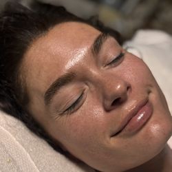 Angels Med Spa Los Angeles - Post facial with glass skin translucent treatment