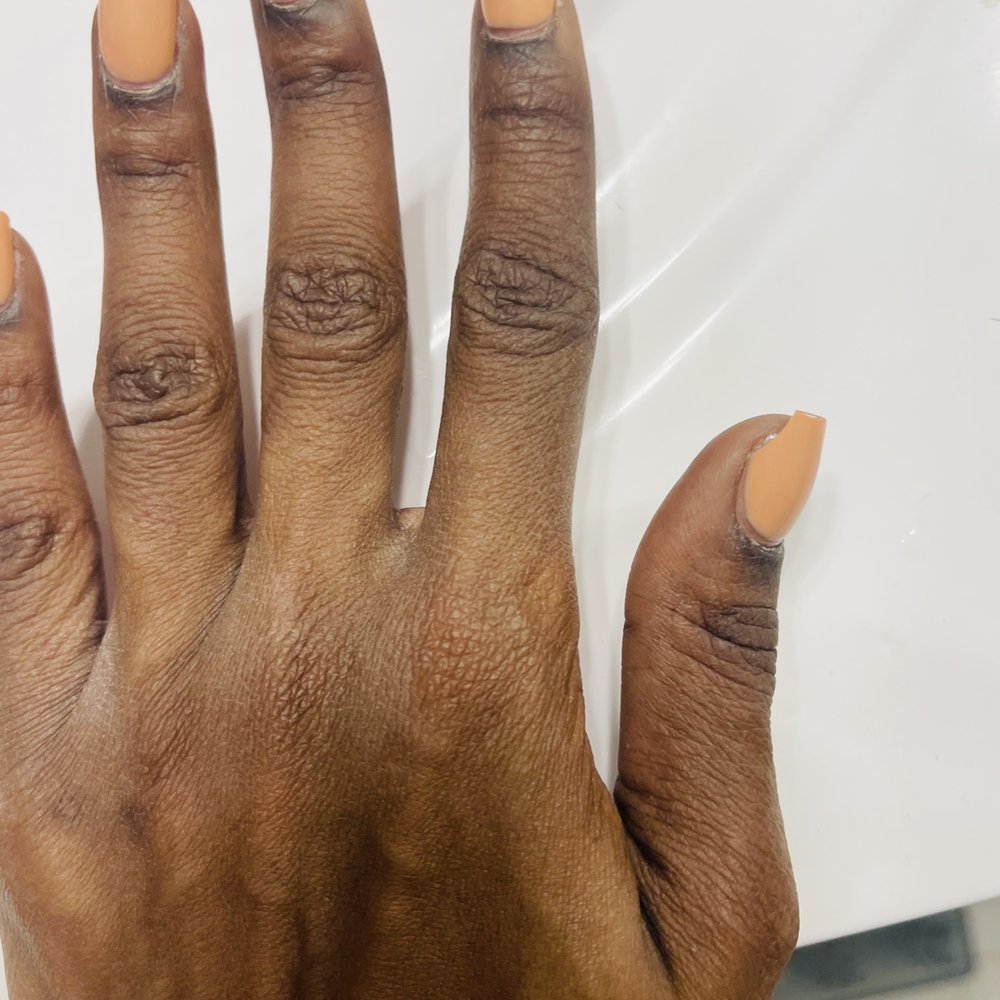 L'Vee Nails Spa - Broken thumb nail - Day Spas Near Me - Bethesda, Maryland L'Vee Nails Spa - Broken thumb nail - Day Spas Near Me - Bethesda, Maryland