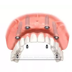 Record Ridge Denture Clinic