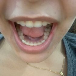 Topanga Dental Care - After