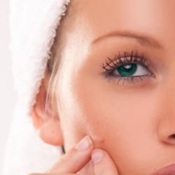 O que é acne?