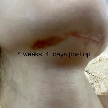 トップス SURGERY destroyed foodie hq720.jpg?sqp=-