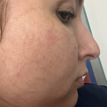 Body Sculpt Skin Laser - Medical Spas Near Me - Vienna, Virginia Body Sculpt Skin Laser - Medical Spas Near Me - Vienna, Virginia