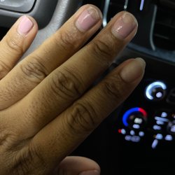 Pro Nails - My chipped nails and the white bruised nails