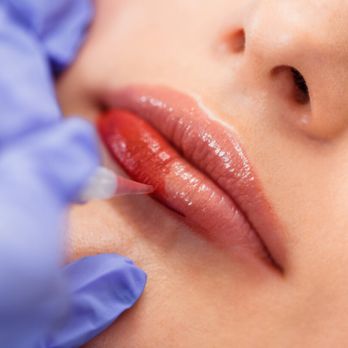 ÉCLAT Skin Confidence Spa - Estheticians Near Me - Cornelius, North Carolina ÉCLAT Skin Confidence Spa - Estheticians Near Me - Cornelius, North Carolina