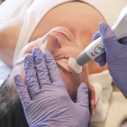 Relished Food Holistic Nutrition - Jet Plasma Skin Rejuvenation. 
Helps with:
- wrinkles & fine lines
- skin texture
- hooded eyes
- acne scarring
- stretch marks