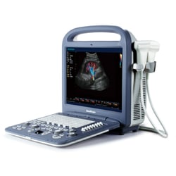 Universal Diagnostic Solutions - Sonoscape S2