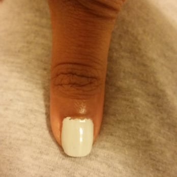 Endless Nail & Spa - And I paid to have this done to most of my cuticles....ugh! - Nail Salons Near Me - Smyrna, Georgia