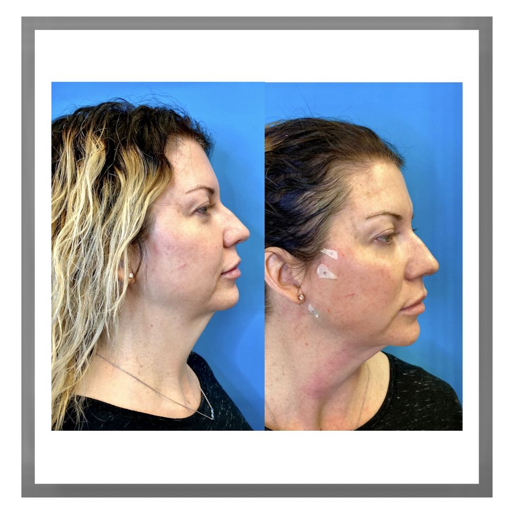 LASER ESSENTIALS MEDICAL SPA Updated September 2024 35 Photos