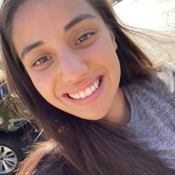 South Valley Dental - This tooth was PERFECT! Matched and fit my other teeth exactly! So happy!