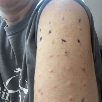 John Simpson, MD - Allergy testing - Allergists Near Me John Simpson, MD - Allergy testing - Allergists Near Me