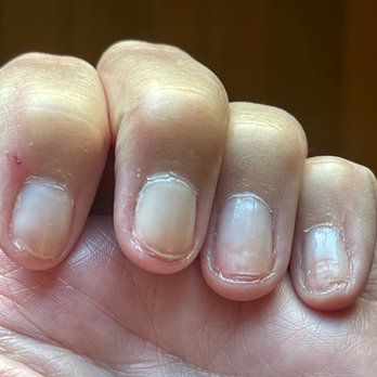 Happy Nails & Spa - Thin nails with splitting - Nail Salons Near Me - Springfield, Illinois Happy Nails & Spa - Thin nails with splitting - Nail Salons Near Me - Springfield, Illinois