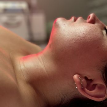 Lavish Bodies - Chin Lipo 1 week post op - Massage Therapy Near Me - Ontario, California Lavish Bodies - Chin Lipo 1 week post op - Massage Therapy Near Me - Ontario, California