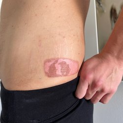 Aqua Spa - Freeze Burn Mark Peeling