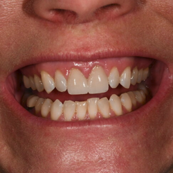 Aesthetic Oral Designs
