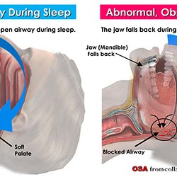 DFW Sleep Solutions