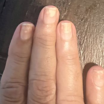 Styland Beauty - Nail fungus - Hair Salons Near Me - Philadelphia, Pennsylvania