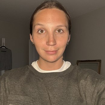 Somenek + Pittman MD: Advanced Plastic Surgery - Nose 1 year post op! - Laser Hair Removal Near Me - Washington, DC, District of Columbia