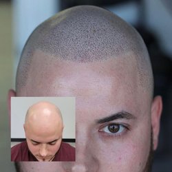 Elements of Shading