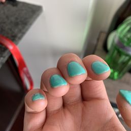 Poorly done gel-shellac manicure Poorly done gel-shellac manicure