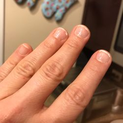 Ann's Nails - Peeling the very next day