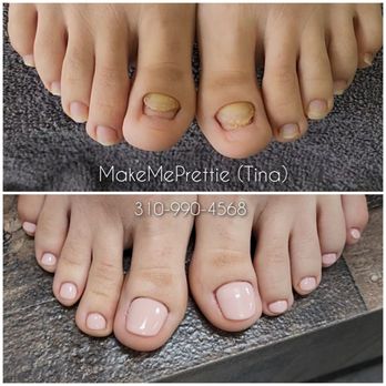 Make Me Prettie - Toenail restoration keryflex Acrylic acrylics builder gel gelx extensions toe nails toe bbl feet pedicurist pedi manicure nails nail - Eyelash Service Near Me Make Me Prettie - Toenail restoration keryflex Acrylic acrylics builder gel gelx extensions toe nails toe bbl feet pedicurist pedi manicure nails nail - Eyelash Service Near Me