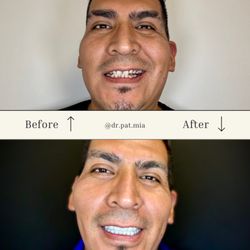 Cosmetistry by Dr P - Smile design