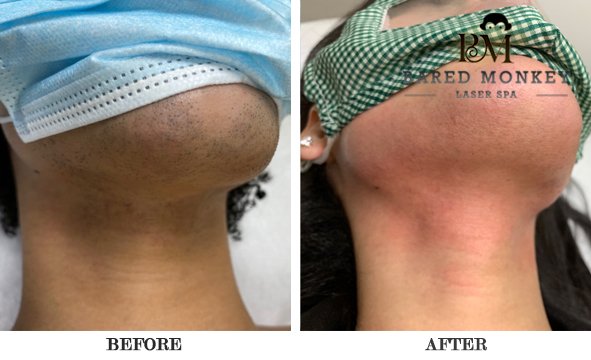 Bared Monkey Laser Spa by null