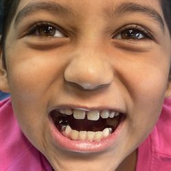 Midland Dentistry 4 Kids - Teeth cleaning