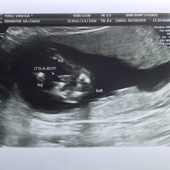 Baby Bump Studios  - It's a boy! - Diagnostic Imaging Near Me - Ontario, California