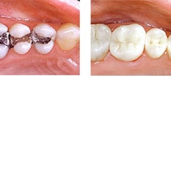 Michael Finkelstein Dentist