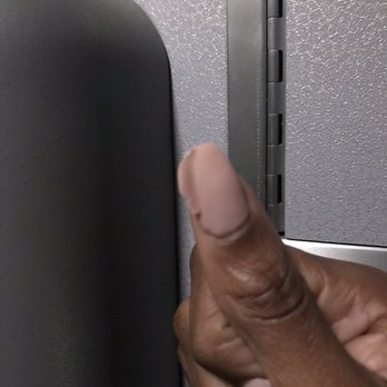 Accent Nail - First set: Day 2. (Notice the lifting of the entire corner) - Nail Salons Near Me - Scarsdale, New York
