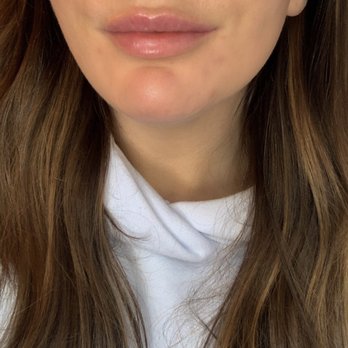 Medical Aesthetics by Caroline - Skin Care Near Me - Wethersfield, Connecticut Medical Aesthetics by Caroline - Skin Care Near Me - Wethersfield, Connecticut