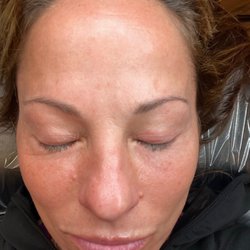 JBe Beauty - Before