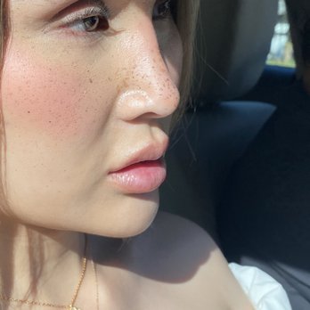 Impressions MedSpa - Cheek, chin, lip filler, and Botox brow lift - Laser Hair Removal Near Me - Fairfax, Virginia