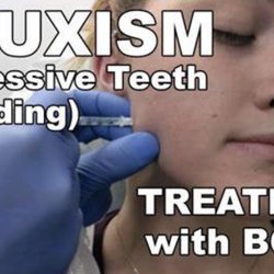 Timeless Radiance - Tox injections can relax your masseter muscle and relieve your jaw clenching.