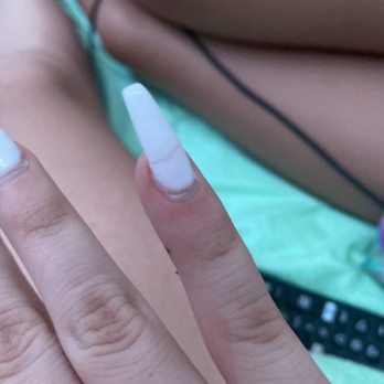 Nail Bar - Mountain View - my half snapped nail. it left my REAL nail damaged AND BRUISED. - Nail Salons Near Me - Mountain View, California Nail Bar - Mountain View - my half snapped nail. it left my REAL nail damaged AND BRUISED. - Nail Salons Near Me - Mountain View, California