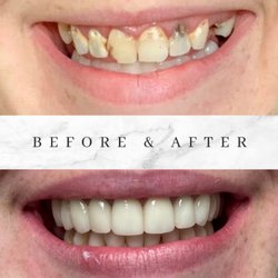 Colts Neck Smiles - Dr. Dilini Peiris