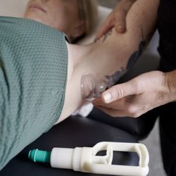 PreventPT - Cupping therapy for shoulder mobility and recovery -- part of a personalized treatment session at PreventPT in Santa Rosa, CA.