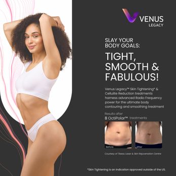 Kamour Spa - At our office suite we offer Venus Legacy treatments to help reduce cellulite, tighten skin and body contouring. - Massage Near Me - Sanford, Florida Kamour Spa - At our office suite we offer Venus Legacy treatments to help reduce cellulite, tighten skin and body contouring. - Massage Near Me - Sanford, Florida